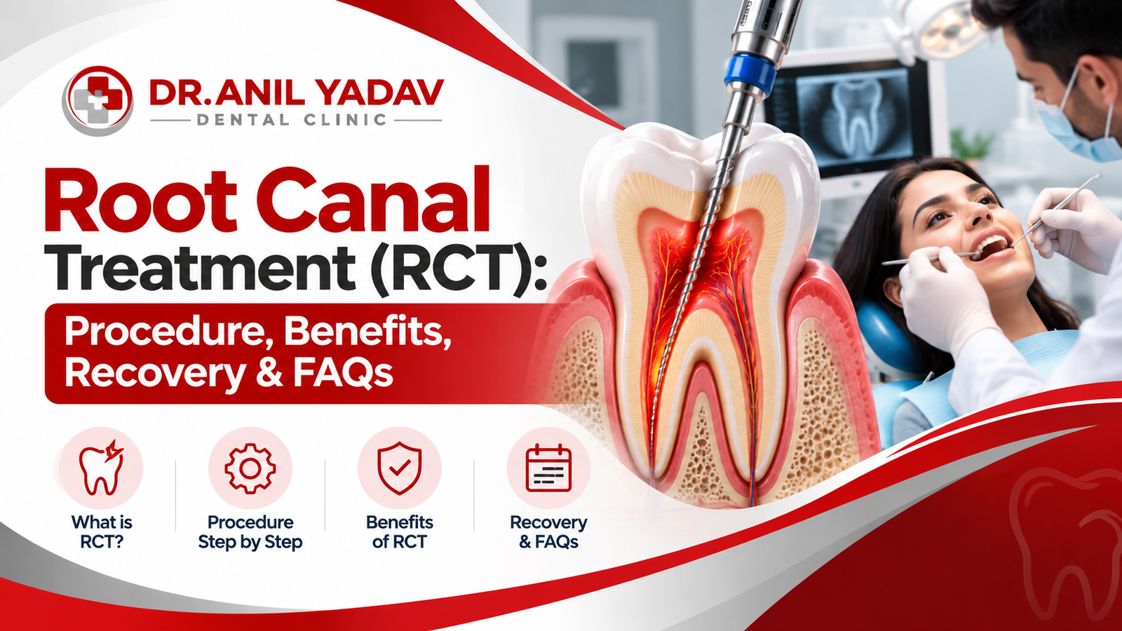 Read more about the article Root Canal Treatment (RCT): Procedure, Benefits, Recovery & FAQs