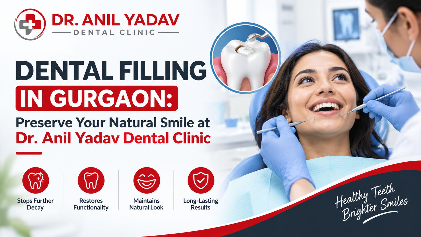 Read more about the article Dental Filling in Gurgaon: Preserve Your Natural Smile at Dr. Anil Yadav Dental Clinic